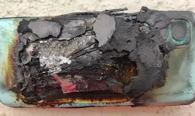 ये स्मार्टफोन बम की तरह फटा: पॉकेट में रखा था मोबाइल, तभी हुआ जोरदार धमाका... युवक हुआ बुरी तरह से जख्मी....