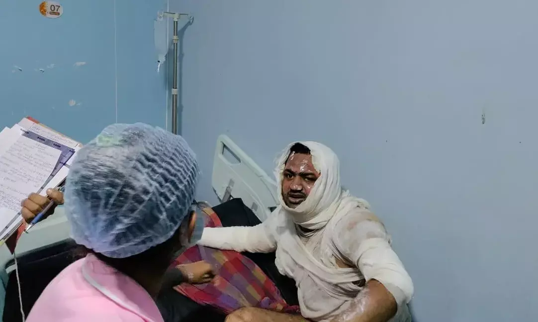 प्रॉपर्टी डीलर को ज़िंदा जलाने की कोशिश?: आपसी विवाद के बाद पेट्रोल डालकर आग लगाने की बात बताई आहत ने.. इलाज जारी.. पुलिस जाँच में जुटी