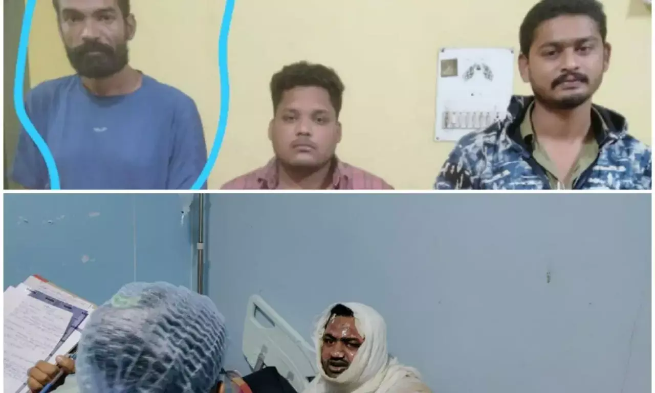 प्रॉपर्टी डीलर को ज़िंदा जलाने का मामला निकला फ़र्ज़ी: राजधानी पुलिस ने CDR के बाद पकड़ा फ़र्ज़ी मामला..विवाहित प्रेमिका के फेर में खुद लगाई थी आग