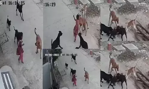 VIDEO: दिल दहला देने वाला वीडियो-कुत्तों ने मासूम को बनाया शिकार... ​​​​​​4 साल ​की बच्ची को कुत्तों के झुंड ने घेरा; सिर, कान और हाथ नोंच खाए