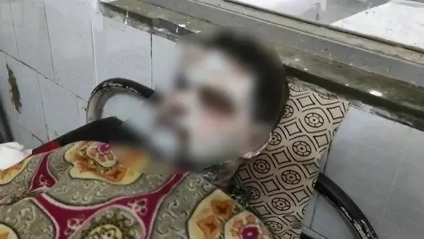 लड़की ने चलती ट्रेन में युवक पर फेंका तेजाब, कई झुलसे... घटना के बाद ट्रेन से कूदकर भागी, मची अफरा-तफरी लड़की ने चलती ट्रेन में युवक पर फेंका तेजाब, कई झुलसे... घटना के बाद ट्रेन से कूदकर भागी, मची अफरा-तफरी