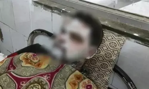 लड़की ने चलती ट्रेन में युवक पर फेंका तेजाब, कई झुलसे... घटना के बाद ट्रेन से कूदकर भागी, मची अफरा-तफरी