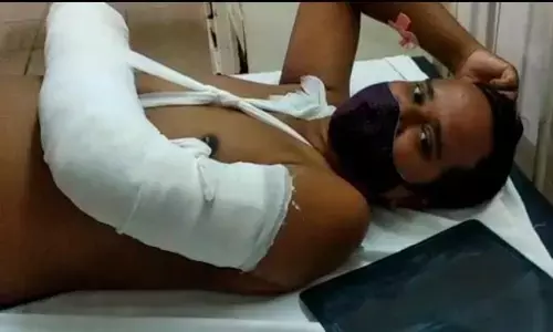 मंत्री ने अधिकारियों को बेदम पीटा... एक का हाथ टूटा तो एक अस्पताल में भर्ती....कमरा बंद कर कुर्सी से पीटा