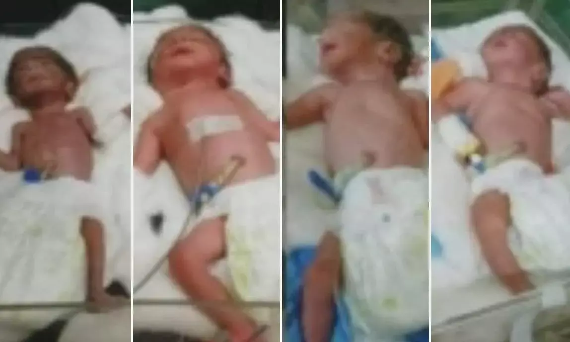 महिला ने एक साथ 4 बच्चों को दिया जन्म... शादी के 10 साल तक नहीं हुए थे बच्चे... पिता ने जताई खुशी