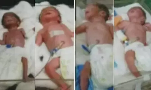 महिला ने एक साथ 4 बच्चों को दिया जन्म... शादी के 10 साल तक नहीं हुए थे बच्चे... पिता ने जताई खुशी