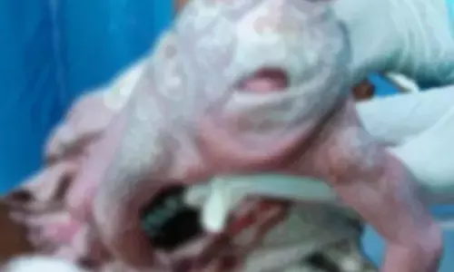 मेंढक जैसी शक्ल वाले बच्चे का जन्म... बिना गर्दन की बॉडी, बड़ी-बड़ी आंखें... महिला को नार्मल डिलीवरी से हुआ अजीब बच्चा...