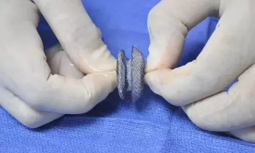 बटन से बंद किया दिल का सुराख: 71 साल के मरीज को हार्ट अटैक, टेढ़ी थी रीढ़, बटन डिवाइस से बंद की दिल की फटी दीवार