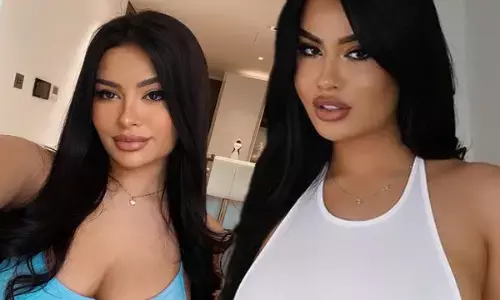 मॉडल की खूबसूरती बनी मुसीबत!, मैं इतनी हॉट हूँ मैं क्या करूँ... जब कोई भी...