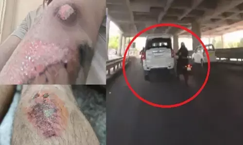 तेज रफ्तार स्कॉर्पियो ने बाइक सवार को ठोका, देखें खौफनाक विडियो