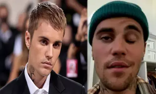 VIDEO: जस्टिन बीबर को खतरनाक बीमारी, आधा चेहरा हुआ पैरालाइज... कहा- हंस भी नही सकता