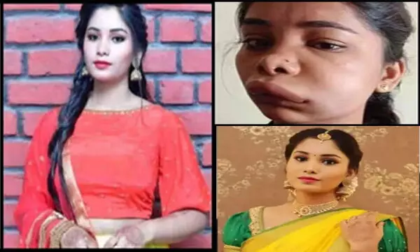 OMG-एक्ट्रेस चेहरा बिगड़ा: दांत की सर्जरी से हुआ ऐसा हाल, अब पहचानना हुआ मुश्किल...