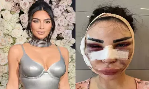 किम कार्दशियन जैसा दिखने को खर्च किए 5 करोड़, हुआ ऐसा हाल.. अब पुराने लुक के लिए रो रहीं