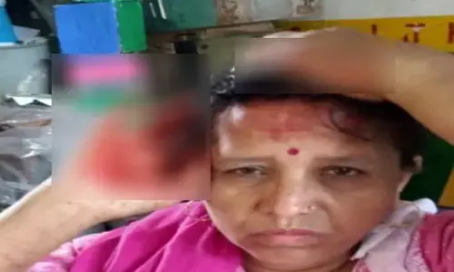 स्कूल के छत की प्लास्टर गिरी, प्रधानपाठिका घायल