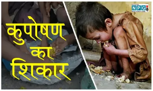 Malnutrition In Child: गरीबों को नहीं अमीरों के बच्चे भी हो रहें कुपोषण का शिकार, जानिए लक्षण और उपाय