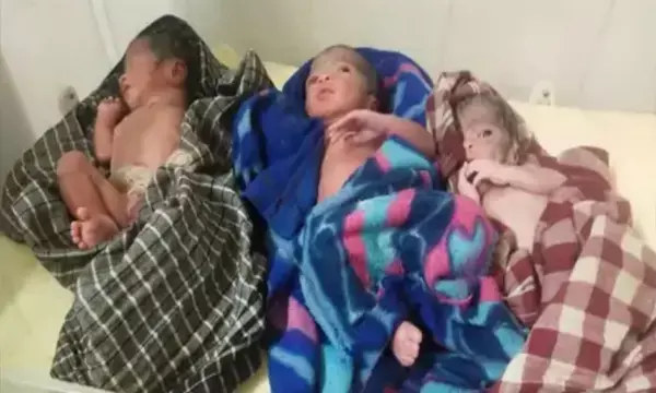 CG News- महिला ने दिया तीन बच्चों को जन्म, प्री-मैच्योर की वजह से दूसरे जिला किया गया रेफर...