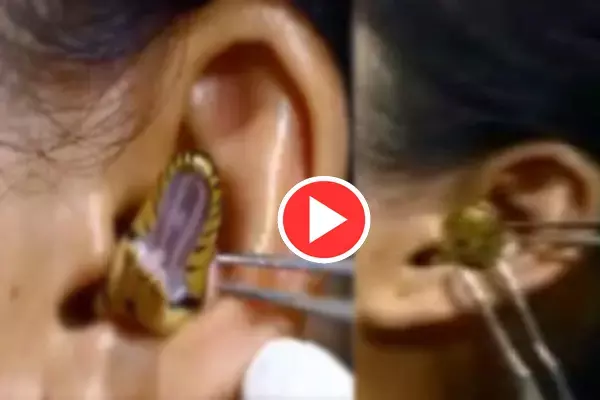 Oh My God!: लड़की के कान में घुस गया सांप, VIDEO देख दहल जाएगा दिल...