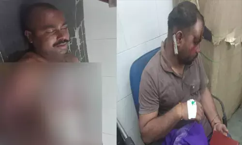 जमीन विवाद में छोटे भाई ने बड़े भाई व भतीजों पर हंसिया व चाकू से किया जानलेवा हमला...