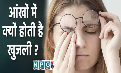 आँखों में खुजली होना: आंखों से जुड़ी समस्या इस समस्या से बचने के लिए लिए अपनाएं ये घरेलू टिप्स, मिलेगी राहत