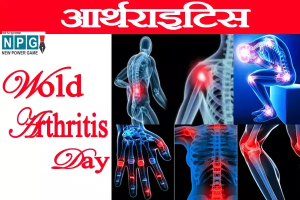 वर्ल्ड आर्थराइटिस डे आज, समय रहते सतर्क होने से संभव है आर्थराइटिस का इलाज