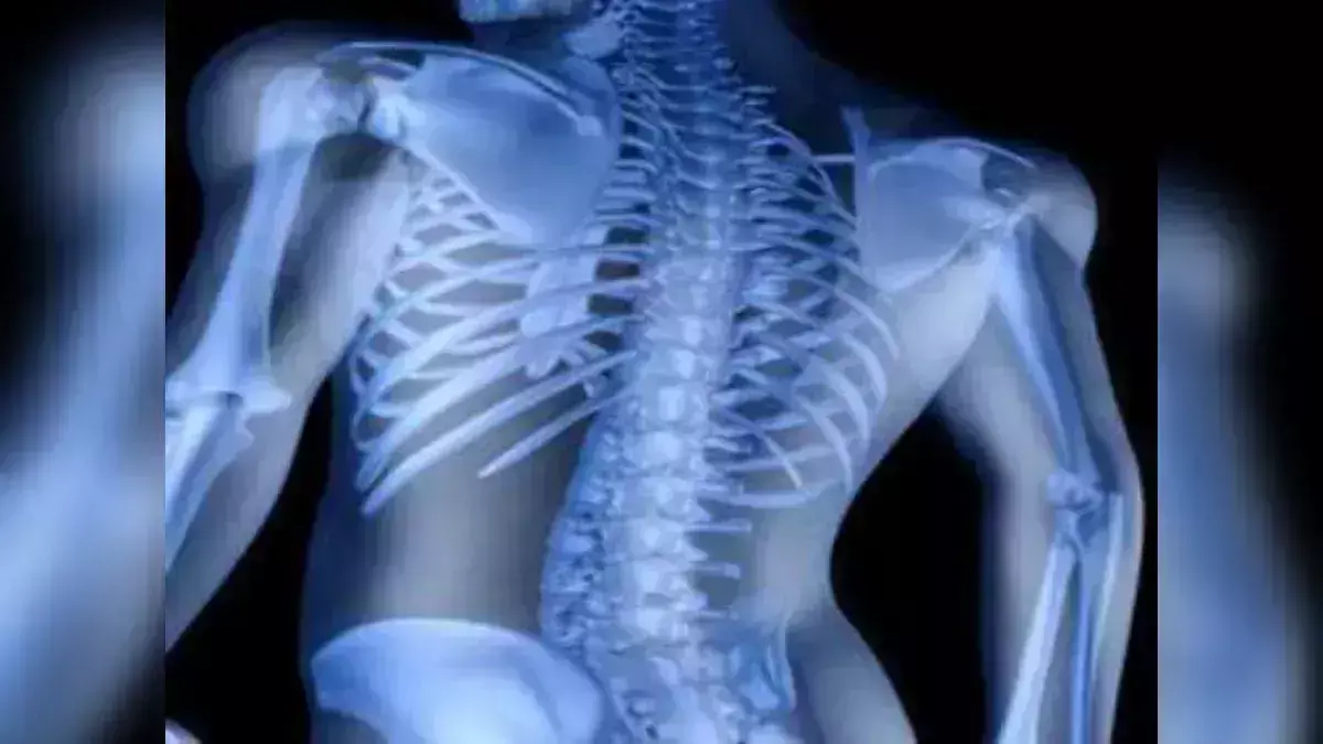 World osteoporosis day (20 October): Bharat me har tin me se ek mahila ko osteoporosis, aapki pith bhi agar aage ki taraf jhuk rahi hai to sawdhan ho jaiye