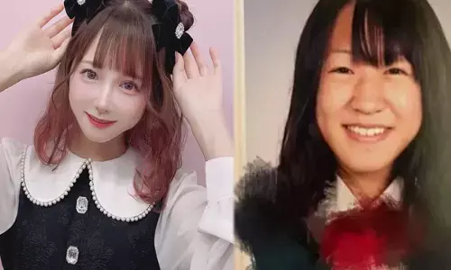 खूबसूरत दिखने के लिए खर्च किया 55 लाख, सर्जरी के बाद अब दिखती है ऐसी...देखकर आपको भी लगेगा शॉक...