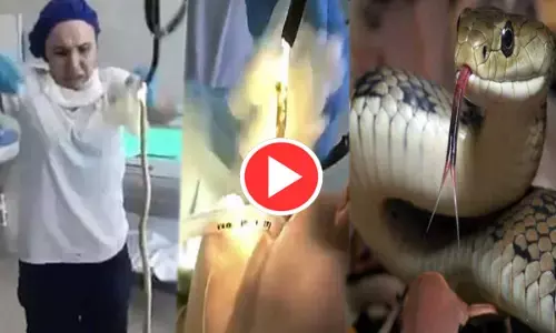 Oh My God: महिला के मुंह में घुसा 4 फीट लंबा सांप, डॉक्टर ने यूं खींचकर निकाला बाहर... VIDEO देख आपके भी उड़ जाएंगे होश...