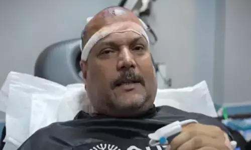 CID के दया ने कराया हेयर ट्रांसप्लांट, बताया एक्सपीरियंस, बोले-गलती से सिर पर कुछ लग जाए तो...