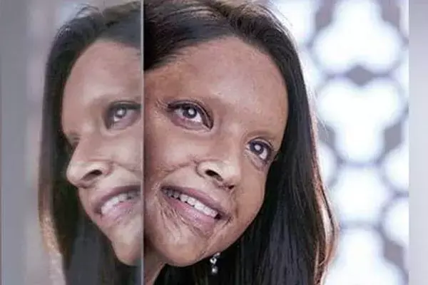 भारत में एसिड अटैक की कुछ चर्चित घटनाएं... जानिए इंडियन पीनल कोड क्या कहता है, क्यों छूट जाते हैं आरोपी