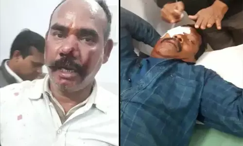 SECL में कबाड़ चोरों का बवाल, चोरी करने से रोकने पर चोरों ने सुरक्षाकर्मियों पर किया जानलेवा हमला, एक की आंख फोड़ी, कई घायल