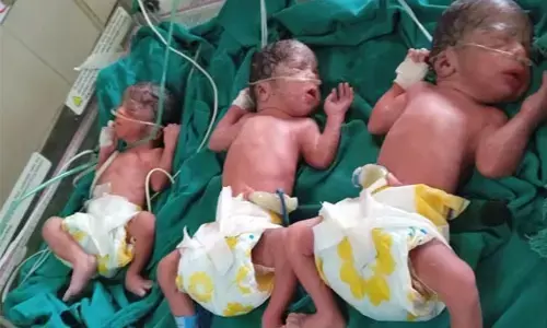 Multiple birth: छत्तीसगढ़ में यहां हुआ एक साथ तीन बच्चों का जन्म... खबर सुनकर सब हैरान, बच्चे और मां...