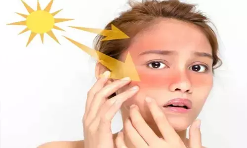 Skin care for ladies facing sunlight regularly: धूप से हो रहा है चेहरे पर बुरा असर तो ये उपाय हैं आपके लिए बहुत काम के