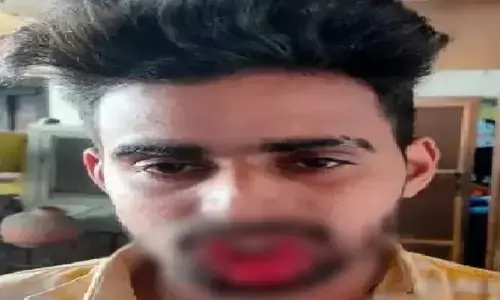 युवक कर रहा था लड़की को जबरन Kiss, फिर लड़की ने काटकर होठ किये अलग, अब कटे होठ लेकर गया जेल...