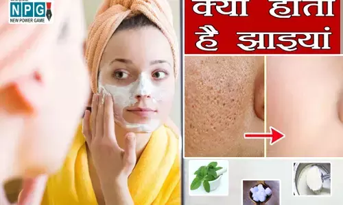 Home Remedies for pigmentation: हल्की होंगी झाइयां, इन आसान उपायों को अपनाकर देखिए...