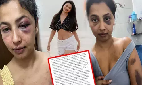 Anika Vikraman-इस खूबसूरत एक्ट्रेस की पिटाई: बॉयफ्रेंड ने मार मारकर सूजा दिया चेहरा, अभिनेत्री ने तस्वीर शेयर कर सुनाई आपबीती...