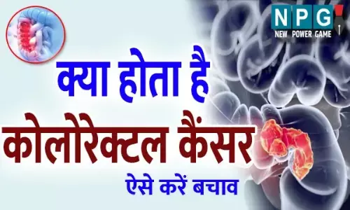 Colorectal Cancer Symptoms: क्या होता है कोलोरेक्टल कैंसर, इसकी शुरूआत में ही बरतें अहतियात, और ऐसे करें बचाव...