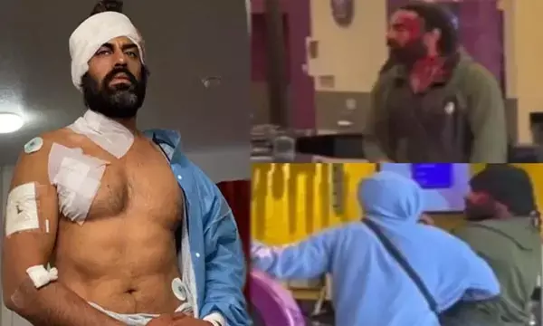 Aman Dhaliwal: मशहूर एक्टर पर कुल्हाड़ी और चाकू से हमला: जिम में वर्कआउट करते वक्त बदमाशों ने अभिनेता पर किया जानलेवा हमला, Video वायरल...