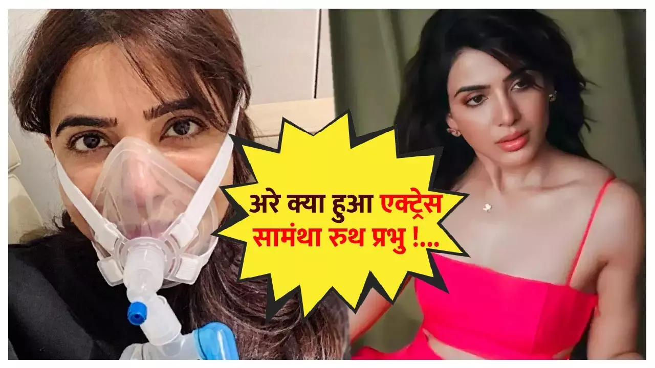 Samantha Ruth Prabhu: अरे क्या हुआ सामंथा रुथ प्रभु को, जिसे देखकर फैंस चौंक गए, बोले-आखिर क्या हो गई एक्ट्रेस की हालत...