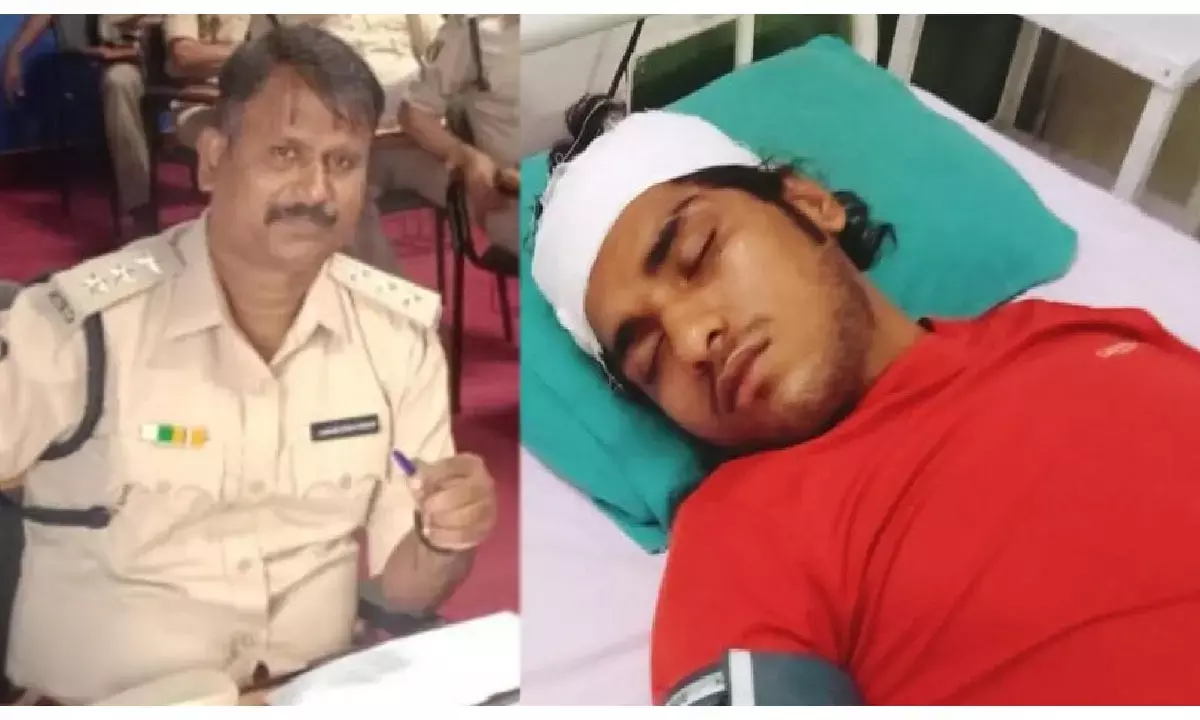 CG News: असिस्टेंट कमांडेंट की दबंगई: बेटे के विवाद में युवकों को जमकर पीटा... अस्पताल में भर्ती...