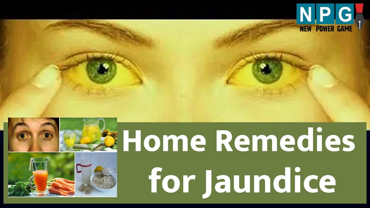 Home Remedies for Jaundice पीलिया से गारंटेड छुटकारा पाने कीजिए ये