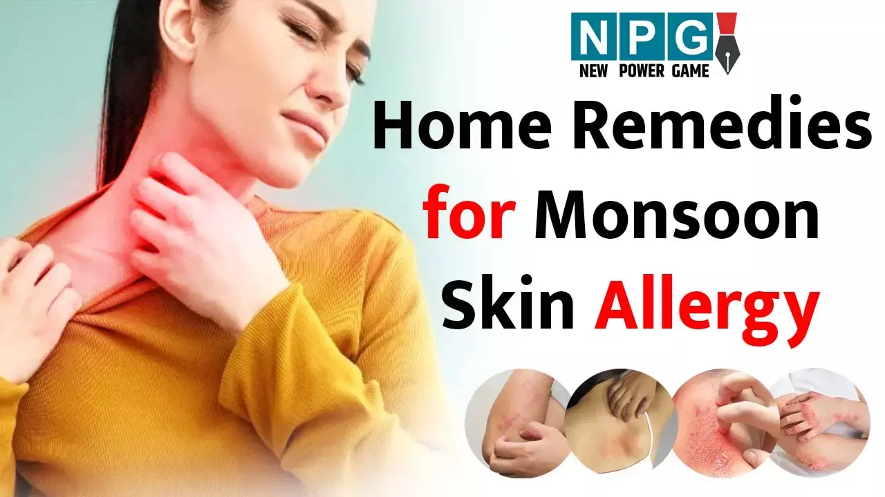 Home Remedies for Monsoon Skin Allergy: मानसून में बढ़ जाती है स्किन एलर्जी, बचने के लिए अपनाइये ये घरेलू उपाय...