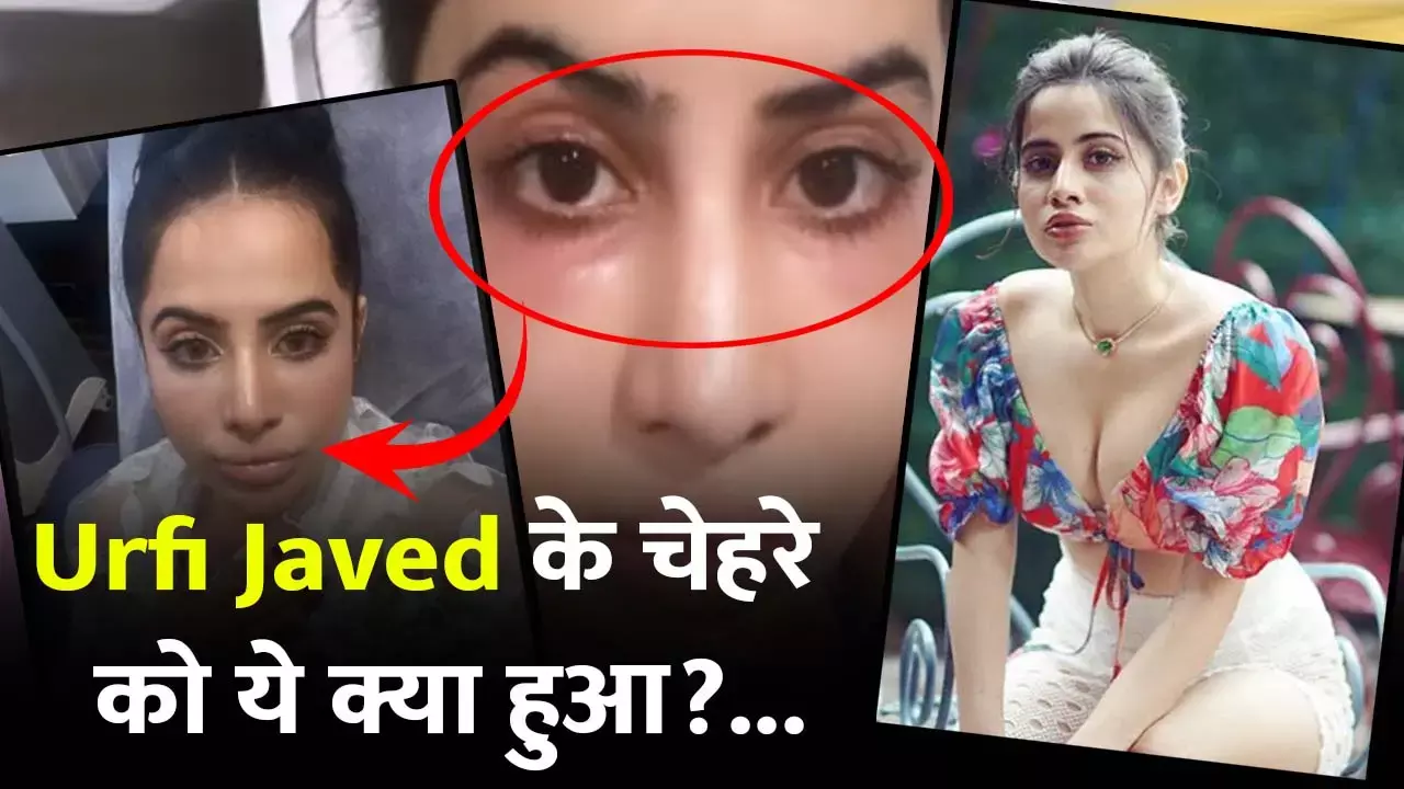 Urfi Javed Surgery: सूजी आंखें, फूल कर गुब्बारा बन गए होंठ: शरीर से खिलवाड़ करने से उर्फी जावेद का चेहरा हुआ बर्बाद...