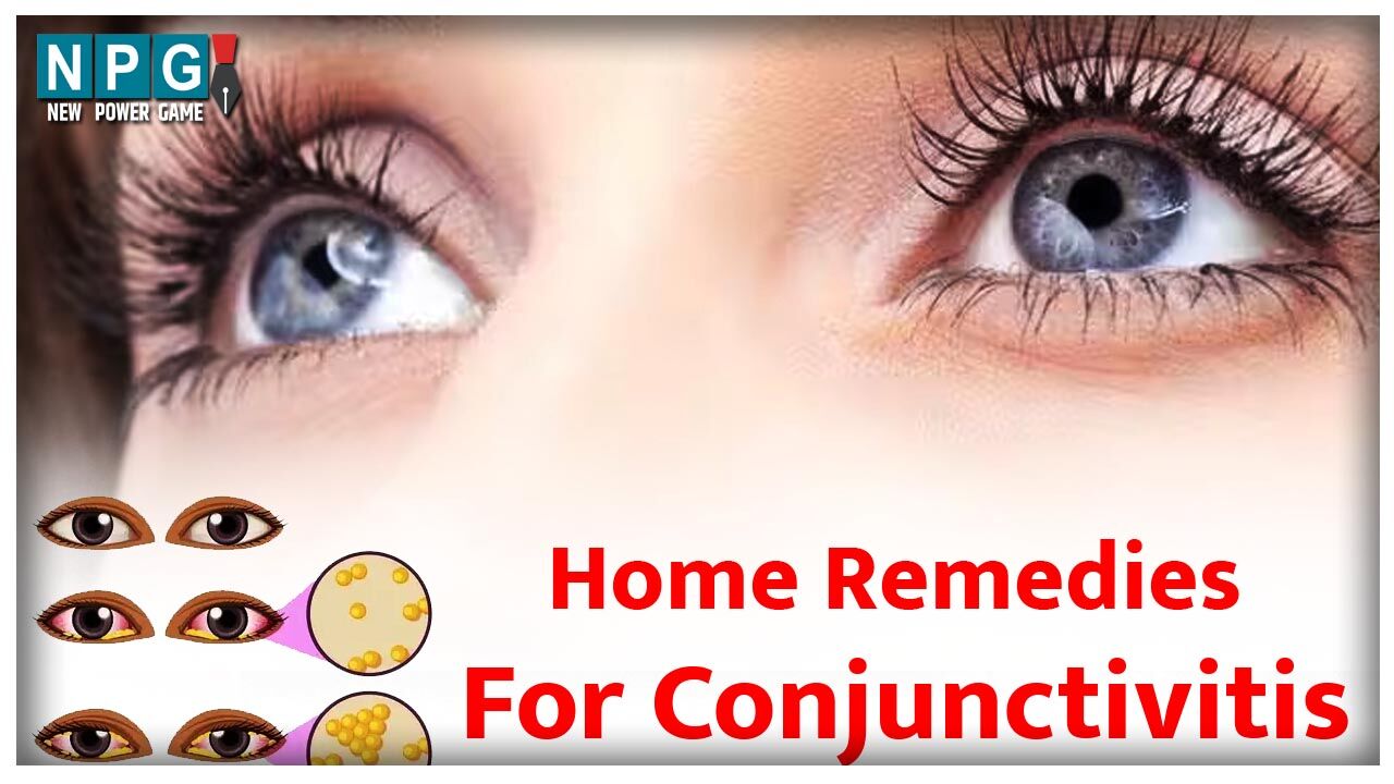 Home Remedies For Conjunctivitis कंजंक्टिवाइटिस यानी आँख आ जाने पर अपनाइये ये घरेलू उपाय जल्द