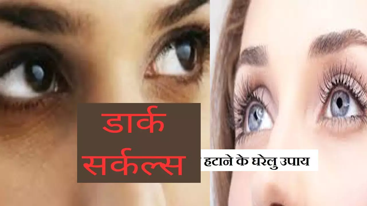 Dark Circle Home Remedies: डार्क सर्कल कैसे कम करें? ये घरेलू उपाय आएंगे काम, हटेगा काला घेरा, जानिए टिप्स Dark Circle Home Remedies: डार्क सर्कल कैसे कम करें? ये घरेलू उपाय आएंगे काम, हटेगा काला घेरा, जानिए टिप्स