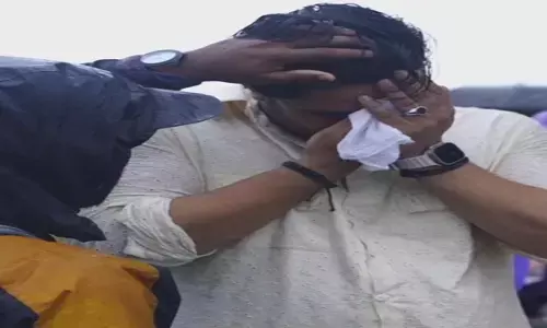 Ali Goni-Jasmine Bhasin: शूटिंग के दौरान इस फेमस एक्टर को आंख में लगी गंभीर चोट, हादसे से मचा हड़कंप, देखें ये वीडियो....