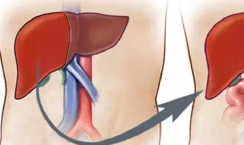 Organ Donation: 59 साल की ब्रेन डेड महिला ने 2 मरीजों को दी नई जिंदगी, दान किया लीवर और आंख