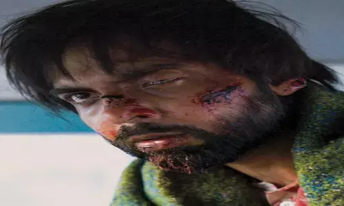 Abhishek Banerjee : एक्टर अभिषेक को ये क्या हुआ!...सूजी आंख, चेहरे पर लगी गहरी चोट और निकले...देखिए वायरल तस्वीरें...