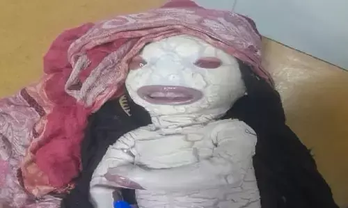 Alien Child Birth News: पैदा हुआ अजीबोगरीब बच्चा, बेटे को देख मां के उड़े होश! लोग कह रहे एलियन