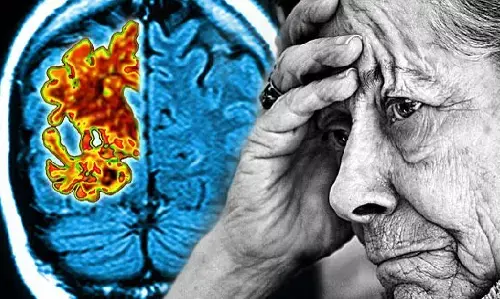 Delhi News: दिल्ली-एनसीआर में 50 वर्ष से कम उम्र के लोगों की याददाश्त हो रही है कम