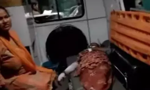 UP News : बिजनौर में 45 वर्षीय महिला पर तेंदुए का हमला, खौफ में गांव