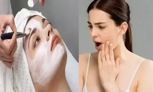 Bleach Ke Nuksan:क्या आप भी करवाती है ब्लीच, इन बातों को फिर न करें नजरअंदाज, जानिए क्यों?